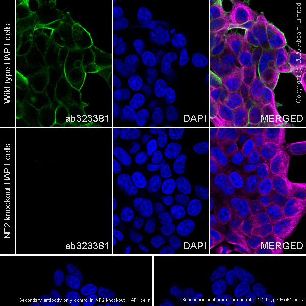 Immunocytochemistry/ Immunofluorescence - Alexa Fluor® 594 Anti-alpha Tubulin antibody [DM1A] - Microtubule Marker (AB195889)