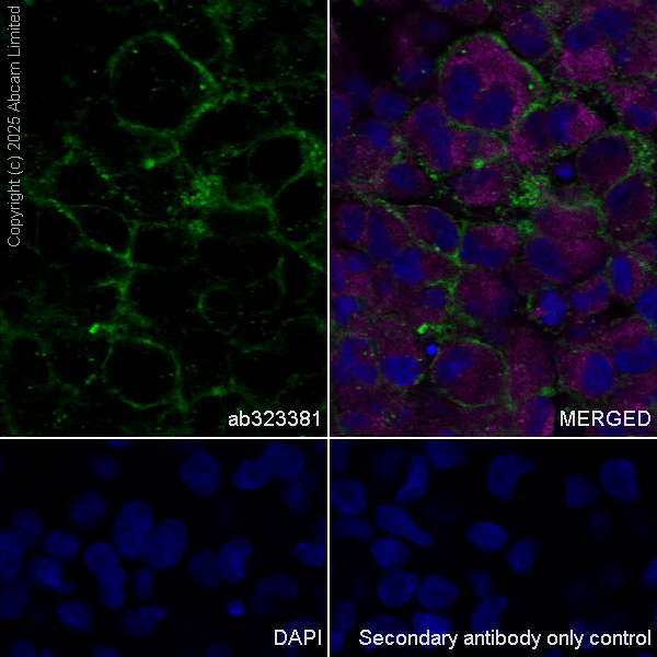 Immunocytochemistry/ Immunofluorescence - Alexa Fluor® 594 Anti-alpha Tubulin antibody [DM1A] - Microtubule Marker (AB195889)