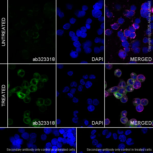 Immunocytochemistry/ Immunofluorescence - Alexa Fluor® 594 Anti-alpha Tubulin antibody [DM1A] - Microtubule Marker (AB195889)