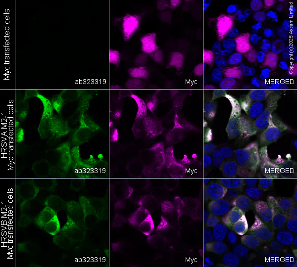 Immunocytochemistry/ Immunofluorescence - Alexa Fluor® 594 Anti-alpha Tubulin antibody [DM1A] - Microtubule Marker (AB195889)