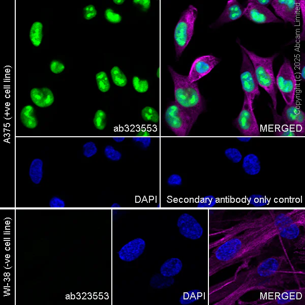 Immunocytochemistry/ Immunofluorescence - Alexa Fluor® 594 Anti-alpha Tubulin antibody [DM1A] - Microtubule Marker (AB195889)