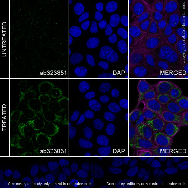 Immunocytochemistry/ Immunofluorescence - Alexa Fluor® 594 Anti-alpha Tubulin antibody [DM1A] - Microtubule Marker (AB195889)