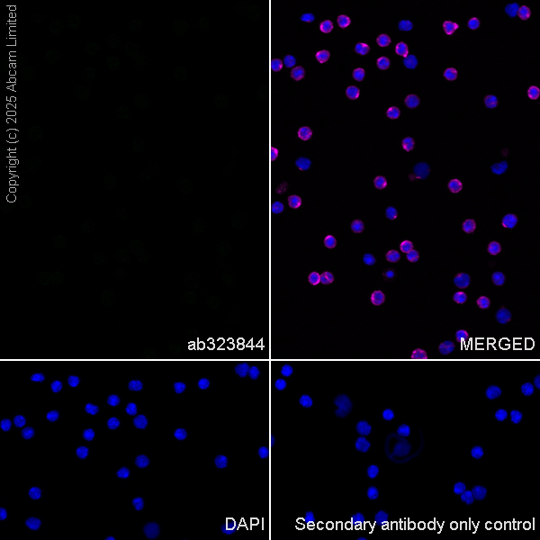 Immunocytochemistry/ Immunofluorescence - Alexa Fluor® 594 Anti-alpha Tubulin antibody [DM1A] - Microtubule Marker (ab195889), expandable thumbnail