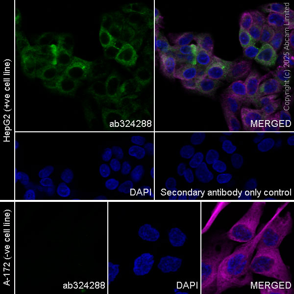 Immunocytochemistry/ Immunofluorescence - Alexa Fluor® 594 Anti-alpha Tubulin antibody [DM1A] - Microtubule Marker (ab195889), expandable thumbnail