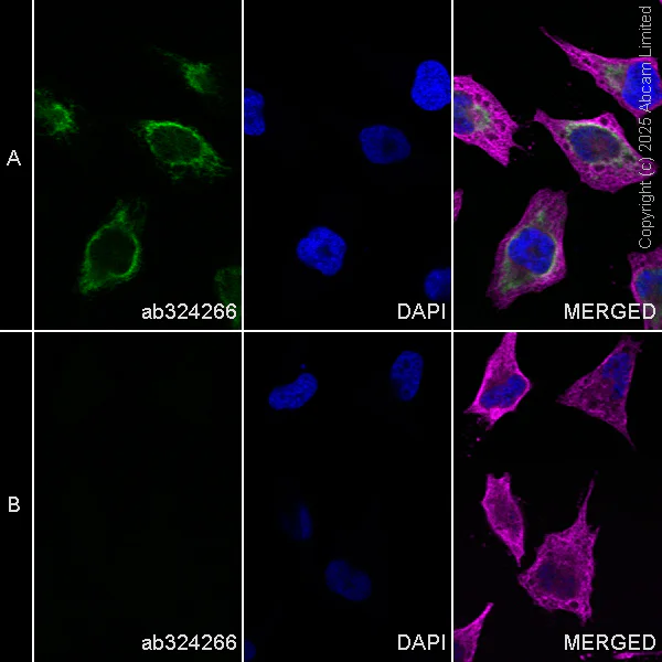 Immunocytochemistry/ Immunofluorescence - Alexa Fluor® 594 Anti-alpha Tubulin antibody [DM1A] - Microtubule Marker (AB195889)