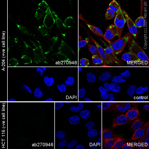 Immunocytochemistry/ Immunofluorescence - Alexa Fluor® 594 Anti-alpha Tubulin antibody [DM1A] - Microtubule Marker (AB195889)