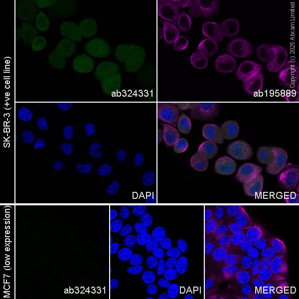 Immunocytochemistry/ Immunofluorescence - Alexa Fluor® 594 Anti-alpha Tubulin antibody [DM1A] - Microtubule Marker (AB195889)