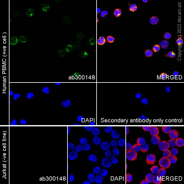 Immunocytochemistry/ Immunofluorescence - Alexa Fluor® 594 Anti-alpha Tubulin antibody [DM1A] - Microtubule Marker (AB195889)