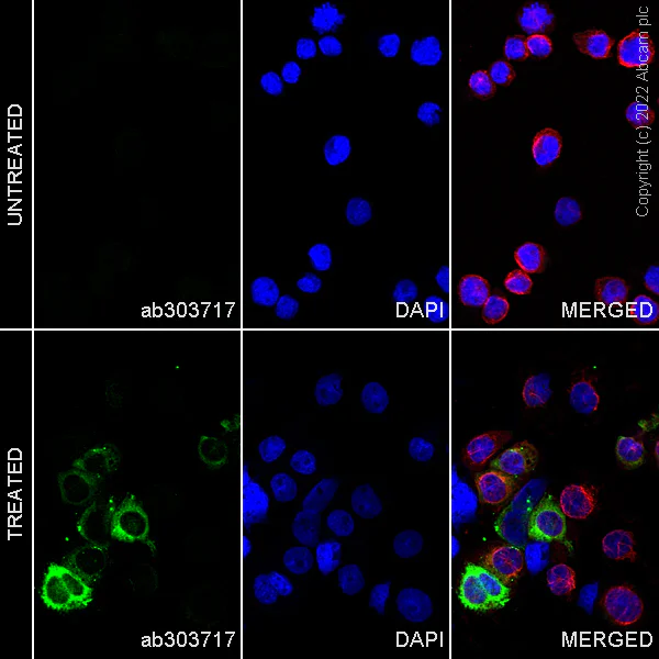 Immunocytochemistry/ Immunofluorescence - Alexa Fluor® 594 Anti-alpha Tubulin antibody [DM1A] - Microtubule Marker (AB195889)