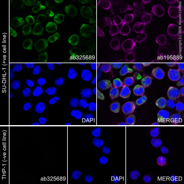 Immunocytochemistry/ Immunofluorescence - Alexa Fluor® 594 Anti-alpha Tubulin antibody [DM1A] - Microtubule Marker (AB195889)