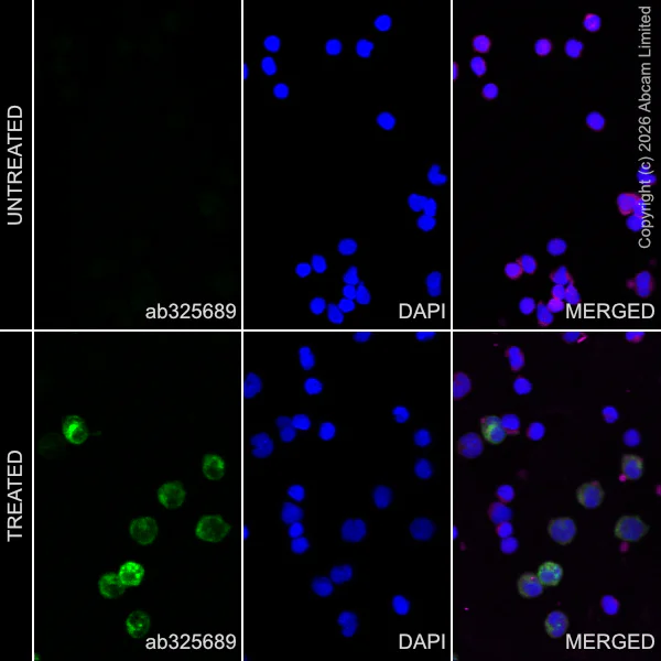 Immunocytochemistry/ Immunofluorescence - Alexa Fluor® 594 Anti-alpha Tubulin antibody [DM1A] - Microtubule Marker (AB195889)