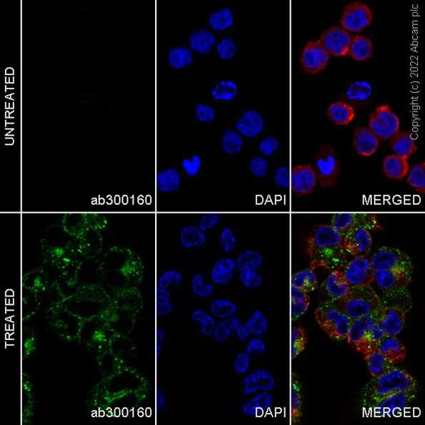 Immunocytochemistry/ Immunofluorescence - Alexa Fluor® 594 Anti-alpha Tubulin antibody [DM1A] - Microtubule Marker (AB195889)