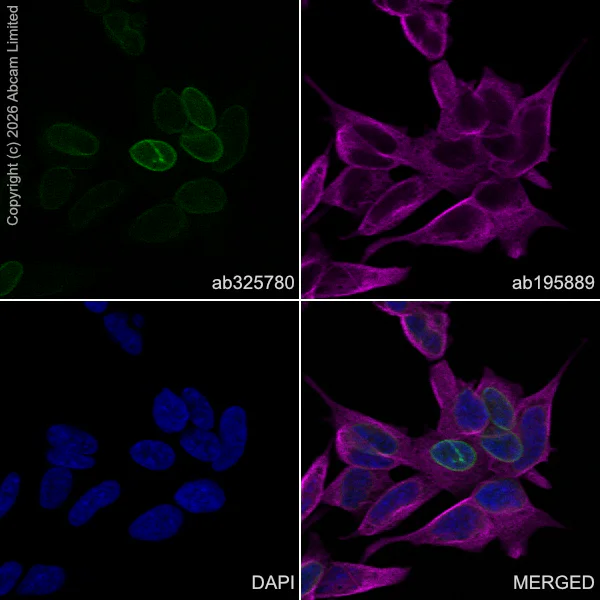 Immunocytochemistry/ Immunofluorescence - Alexa Fluor® 594 Anti-alpha Tubulin antibody [DM1A] - Microtubule Marker (AB195889)