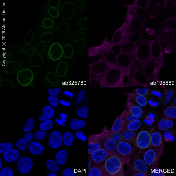 Immunocytochemistry/ Immunofluorescence - Alexa Fluor® 594 Anti-alpha Tubulin antibody [DM1A] - Microtubule Marker (AB195889)