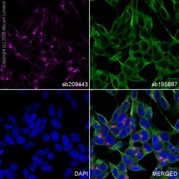 Immunocytochemistry/ Immunofluorescence - Alexa Fluor® 594 Anti-alpha Tubulin antibody [DM1A] - Microtubule Marker (AB195889)
