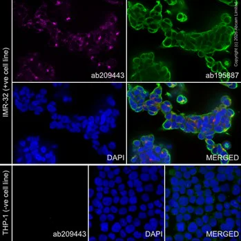Immunocytochemistry/ Immunofluorescence - Alexa Fluor® 594 Anti-alpha Tubulin antibody [DM1A] - Microtubule Marker (AB195889)