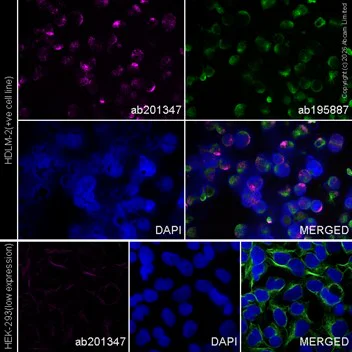 Immunocytochemistry/ Immunofluorescence - Alexa Fluor® 594 Anti-alpha Tubulin antibody [DM1A] - Microtubule Marker (AB195889)