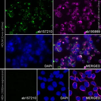 Immunocytochemistry/ Immunofluorescence - Alexa Fluor® 594 Anti-alpha Tubulin antibody [DM1A] - Microtubule Marker (AB195889)