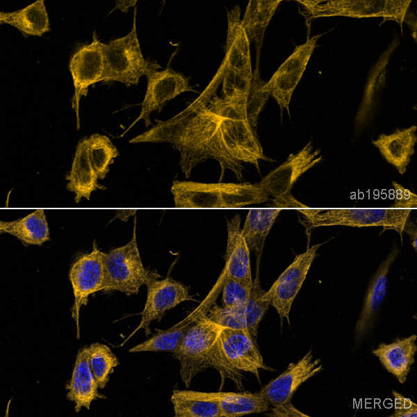 Immunocytochemistry/ Immunofluorescence - Alexa Fluor® 594 Anti-alpha Tubulin antibody [DM1A] - Microtubule Marker (ab195889), expandable thumbnail