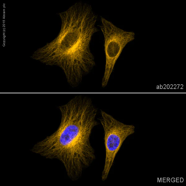 Immunocytochemistry/ Immunofluorescence - Alexa Fluor® 594 Anti-alpha Tubulin antibody [EP1332Y] - Microtubule Marker (AB202272)