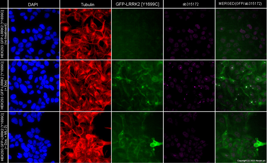Immunocytochemistry/ Immunofluorescence - Alexa Fluor® 594 Anti-alpha Tubulin antibody [EP1332Y] - Microtubule Marker (ab202272), expandable thumbnail