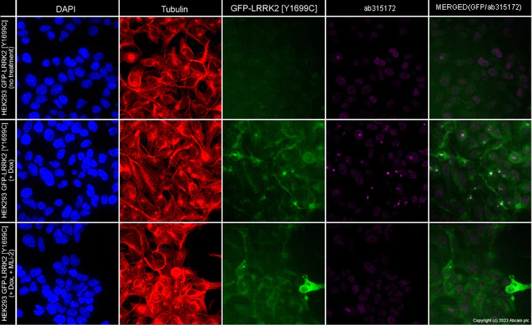Immunocytochemistry/ Immunofluorescence - Alexa Fluor® 594 Anti-alpha Tubulin antibody [EP1332Y] - Microtubule Marker (AB202272)