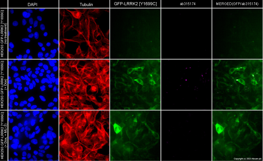 Immunocytochemistry/ Immunofluorescence - Alexa Fluor® 594 Anti-alpha Tubulin antibody [EP1332Y] - Microtubule Marker (ab202272), expandable thumbnail
