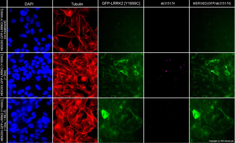 Immunocytochemistry/ Immunofluorescence - Alexa Fluor® 594 Anti-alpha Tubulin antibody [EP1332Y] - Microtubule Marker (AB202272)