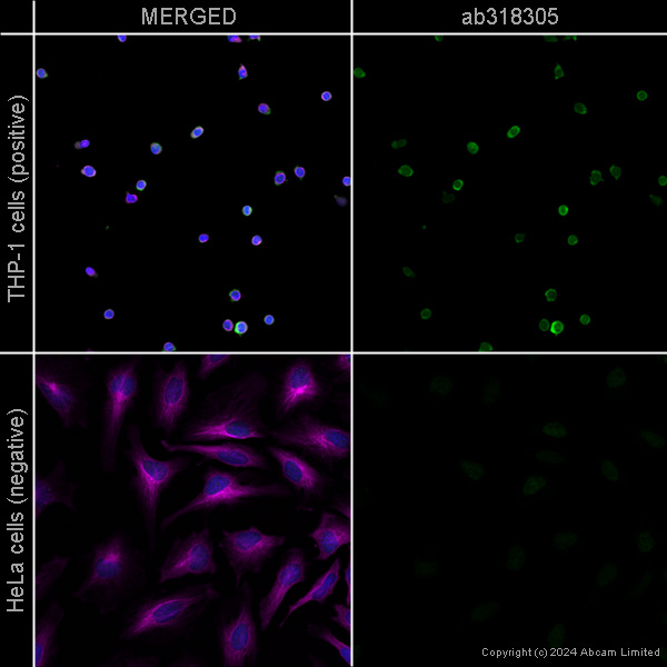 Immunocytochemistry/ Immunofluorescence - Alexa Fluor® 594 Anti-alpha Tubulin antibody [EP1332Y] - Microtubule Marker (ab202272), expandable thumbnail