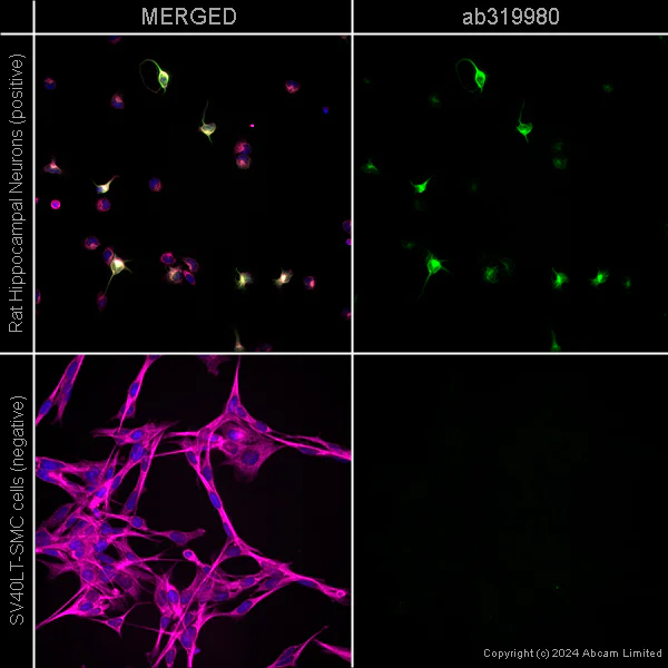 Immunocytochemistry/ Immunofluorescence - Alexa Fluor® 594 Anti-alpha Tubulin antibody [EP1332Y] - Microtubule Marker (AB202272)