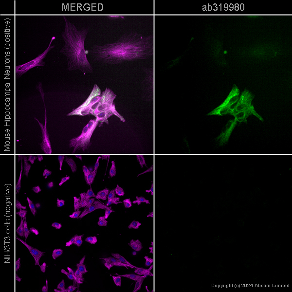 Immunocytochemistry/ Immunofluorescence - Alexa Fluor® 594 Anti-alpha Tubulin antibody [EP1332Y] - Microtubule Marker (ab202272), expandable thumbnail