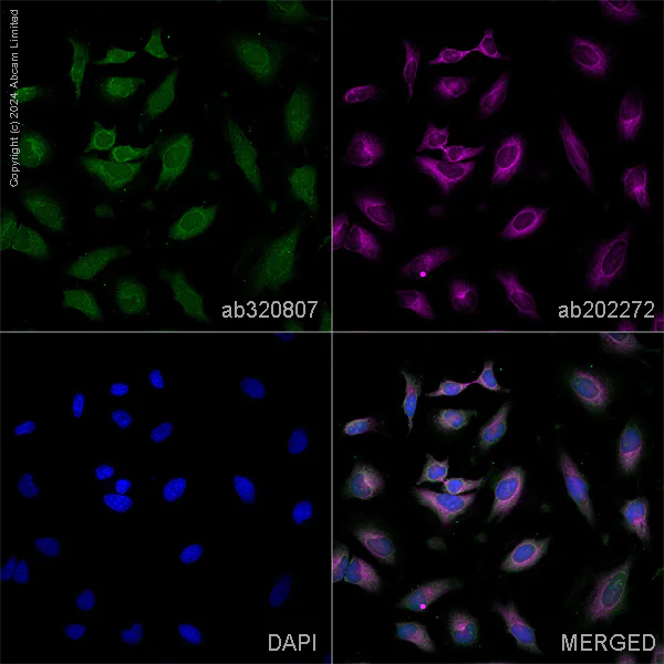 Immunocytochemistry/ Immunofluorescence - Alexa Fluor® 594 Anti-alpha Tubulin antibody [EP1332Y] - Microtubule Marker (AB202272)