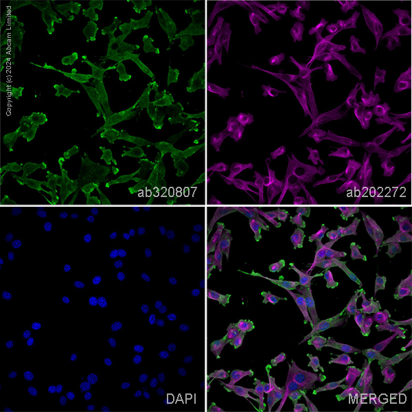 Immunocytochemistry/ Immunofluorescence - Alexa Fluor® 594 Anti-alpha Tubulin antibody [EP1332Y] - Microtubule Marker (ab202272), expandable thumbnail