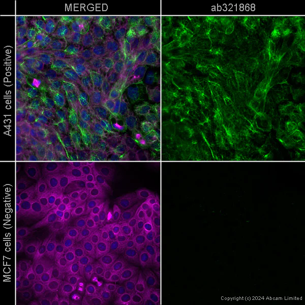 Immunocytochemistry/ Immunofluorescence - Alexa Fluor® 594 Anti-alpha Tubulin antibody [EP1332Y] - Microtubule Marker (AB202272)