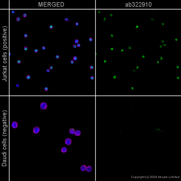 Immunocytochemistry/ Immunofluorescence - Alexa Fluor® 594 Anti-alpha Tubulin antibody [EP1332Y] - Microtubule Marker (ab202272), expandable thumbnail