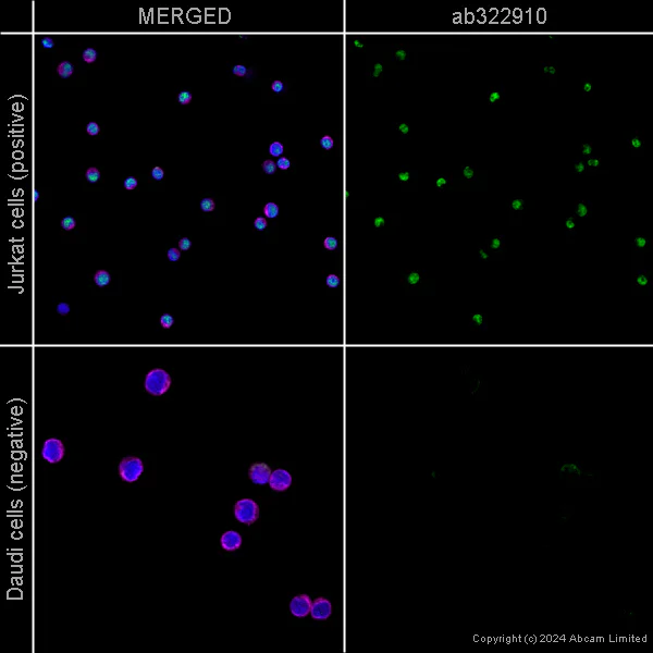 Immunocytochemistry/ Immunofluorescence - Alexa Fluor® 594 Anti-alpha Tubulin antibody [EP1332Y] - Microtubule Marker (AB202272)