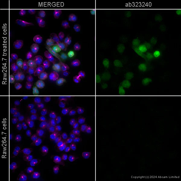Immunocytochemistry/ Immunofluorescence - Alexa Fluor® 594 Anti-alpha Tubulin antibody [EP1332Y] - Microtubule Marker (AB202272)
