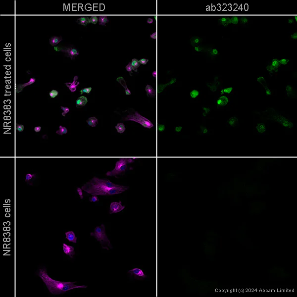 Immunocytochemistry/ Immunofluorescence - Alexa Fluor® 594 Anti-alpha Tubulin antibody [EP1332Y] - Microtubule Marker (AB202272)