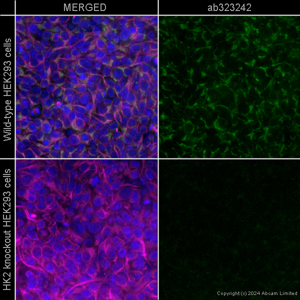 Immunocytochemistry/ Immunofluorescence - Alexa Fluor® 594 Anti-alpha Tubulin antibody [EP1332Y] - Microtubule Marker (ab202272), expandable thumbnail