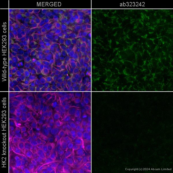 Immunocytochemistry/ Immunofluorescence - Alexa Fluor® 594 Anti-alpha Tubulin antibody [EP1332Y] - Microtubule Marker (AB202272)