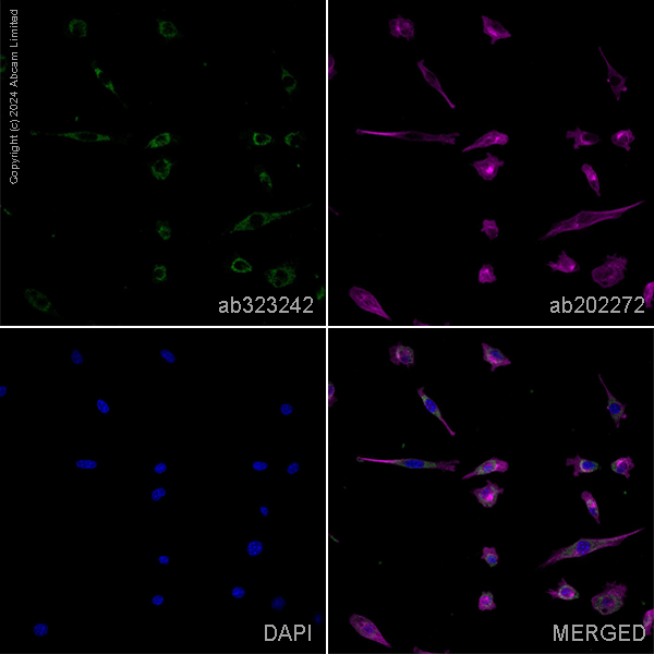 Immunocytochemistry/ Immunofluorescence - Alexa Fluor® 594 Anti-alpha Tubulin antibody [EP1332Y] - Microtubule Marker (ab202272), expandable thumbnail