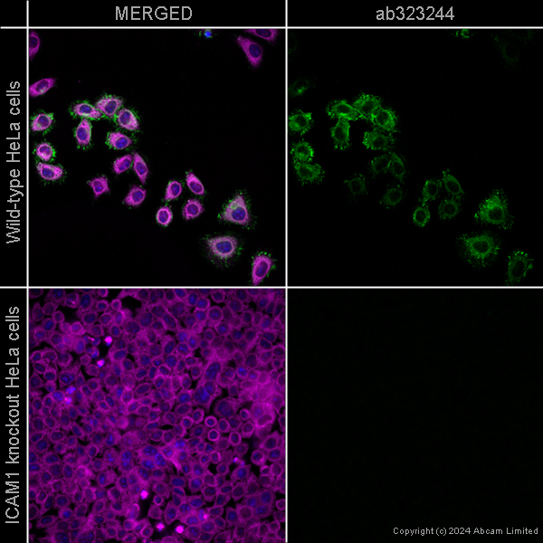 Immunocytochemistry/ Immunofluorescence - Alexa Fluor® 594 Anti-alpha Tubulin antibody [EP1332Y] - Microtubule Marker (ab202272), expandable thumbnail