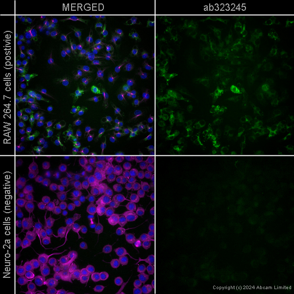 Immunocytochemistry/ Immunofluorescence - Alexa Fluor® 594 Anti-alpha Tubulin antibody [EP1332Y] - Microtubule Marker (ab202272), expandable thumbnail