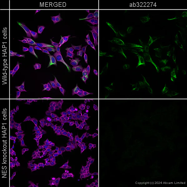 Immunocytochemistry/ Immunofluorescence - Alexa Fluor® 594 Anti-alpha Tubulin antibody [EP1332Y] - Microtubule Marker (AB202272)