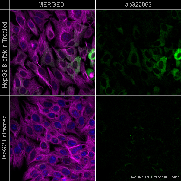 Immunocytochemistry/ Immunofluorescence - Alexa Fluor® 594 Anti-alpha Tubulin antibody [EP1332Y] - Microtubule Marker (ab202272), expandable thumbnail