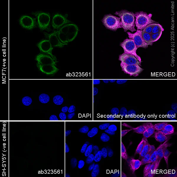 Immunocytochemistry/ Immunofluorescence - Alexa Fluor® 594 Anti-alpha Tubulin antibody [EP1332Y] - Microtubule Marker (AB202272)