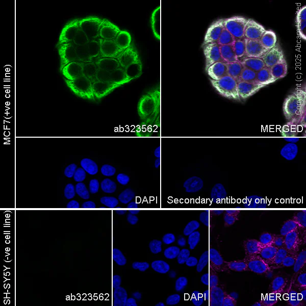Immunocytochemistry/ Immunofluorescence - Alexa Fluor® 594 Anti-alpha Tubulin antibody [EP1332Y] - Microtubule Marker (AB202272)