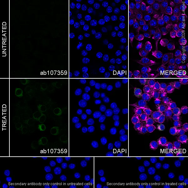 Immunocytochemistry/ Immunofluorescence - Alexa Fluor® 594 Anti-alpha Tubulin antibody [EP1332Y] - Microtubule Marker (AB202272)