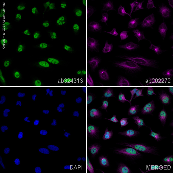 Immunocytochemistry/ Immunofluorescence - Alexa Fluor® 594 Anti-alpha Tubulin antibody [EP1332Y] - Microtubule Marker (ab202272), expandable thumbnail