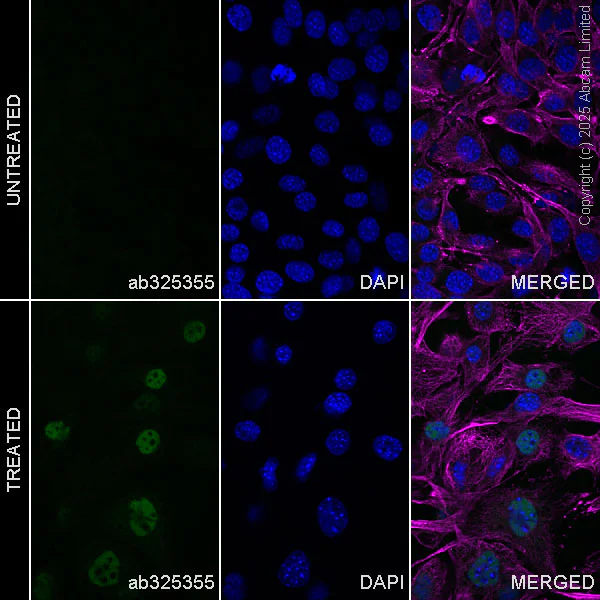 Immunocytochemistry/ Immunofluorescence - Alexa Fluor® 594 Anti-alpha Tubulin antibody [EP1332Y] - Microtubule Marker (AB202272)